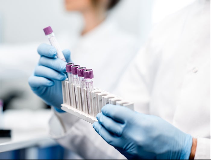 Stock - tightly cropped photo of lab worker, wearing white lab coat and blue latex gloves, handling test tubes