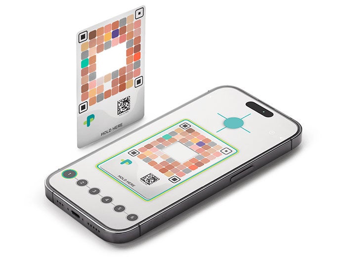 Intermountain. Image depicts jaundic app on a smartphone screen.