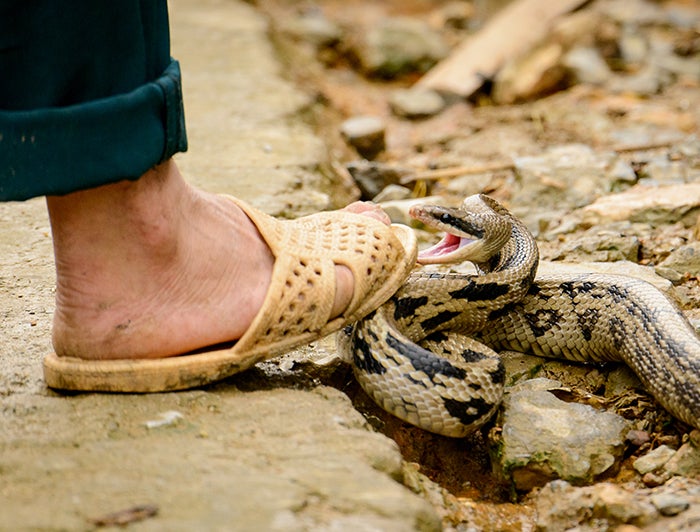 UW Medicine. A sandaled foot stands next to a coiled snake about to strike