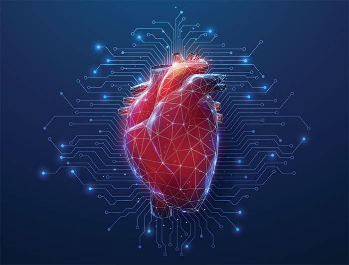 Telling the Hospital Story: Ochsner Heath implements AI-powered technology to support AFib treatment - stock image of a heart with circuitry overlaid