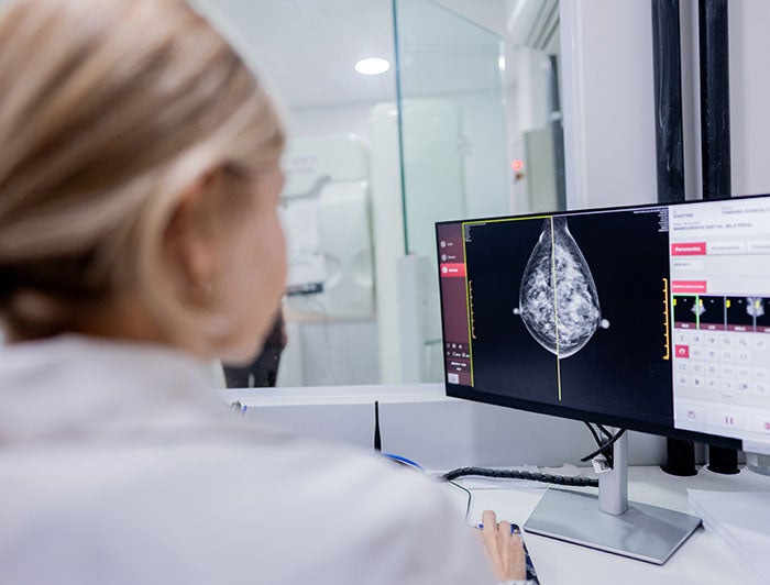 woman wearing white lab coat reviews breast imaging scans