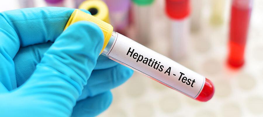 Hepatitis A Test vial