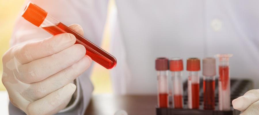 A hand holds a test tube of red fluid. 