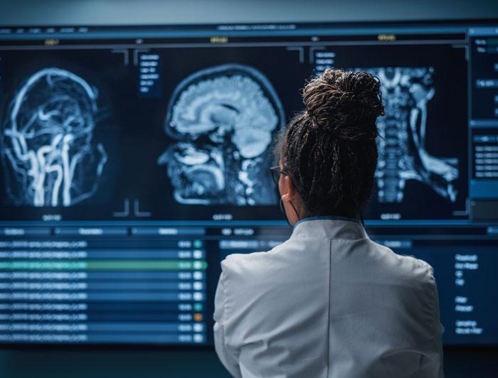 A woman wearing white medical coat stands staring at a brain scan