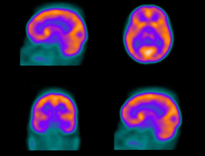 brain scans