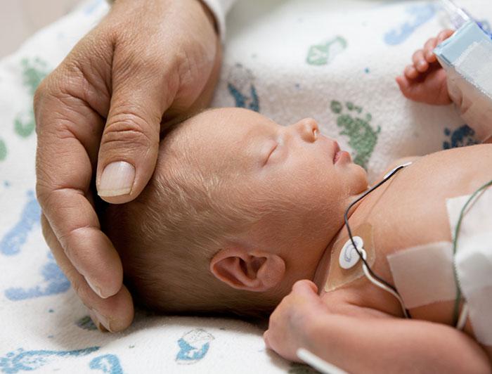 Adult hand cradling a sleeping NICU infant's head