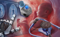 4 Health Systems Transforming Care with AI. A collage of examining a fetus in utero for congenital heart defects, a AI-powered digital stethoscope that can help identify peripartum cardiomyopathy, a robotic hand identifying irregularities in a brain scan, and a AI-powered device for remote patient care and fall prevention.